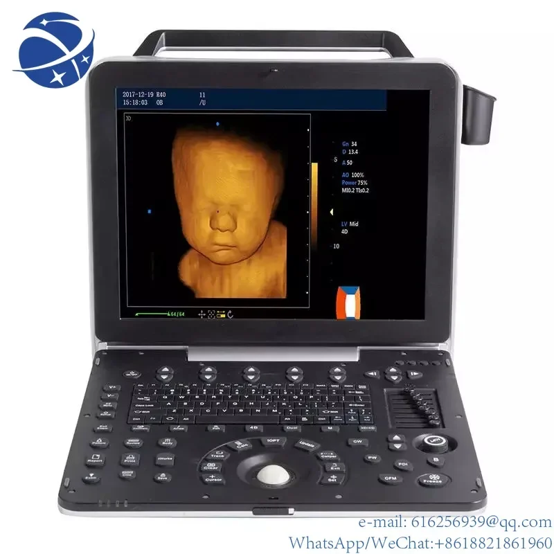 Medical Ultra sound Diagnostic Equipment Full Digital Portable Ultrasound Machine
Medical Ultra sound Diagnostic Equipment Full Digital Portable Ultrasound Machine