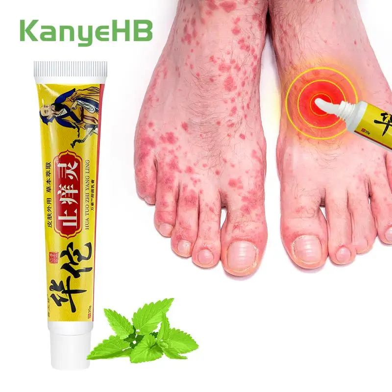 1pc Urticaria Dermatitis Ointment For Treating Skin Inflammation, Redness, And Swelling, Reducing Bacterial Growth Ointment S077
1pc Urticaria Dermatitis Ointment For Treating Skin Inflammation, Redness, And Swelling, Reducing Bacterial Growth Ointment S077