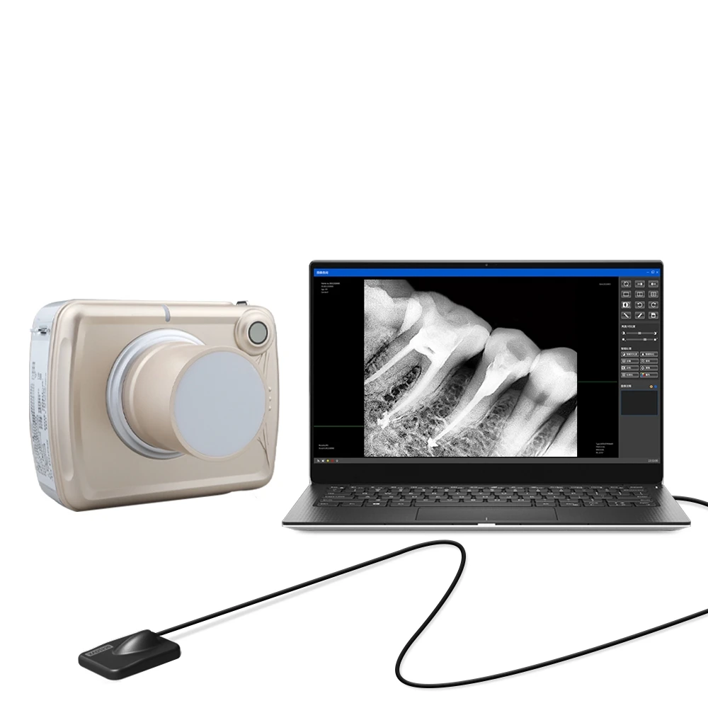 Dental Portable Digital X-Ray With Image Sensor Kits For Veterinary Clinics Dental Equipments
Dental Portable Digital X-Ray With Image Sensor Kits For Veterinary Clinics Dental Equipments