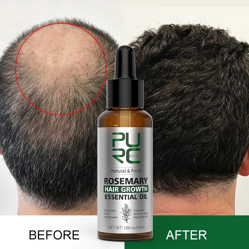 

PURC Rosemary Oil Hair Growth for Men Women Fast Grow Serum Products Ginger Anti Hair Loss Scalp Treatment Hair Care 50ml