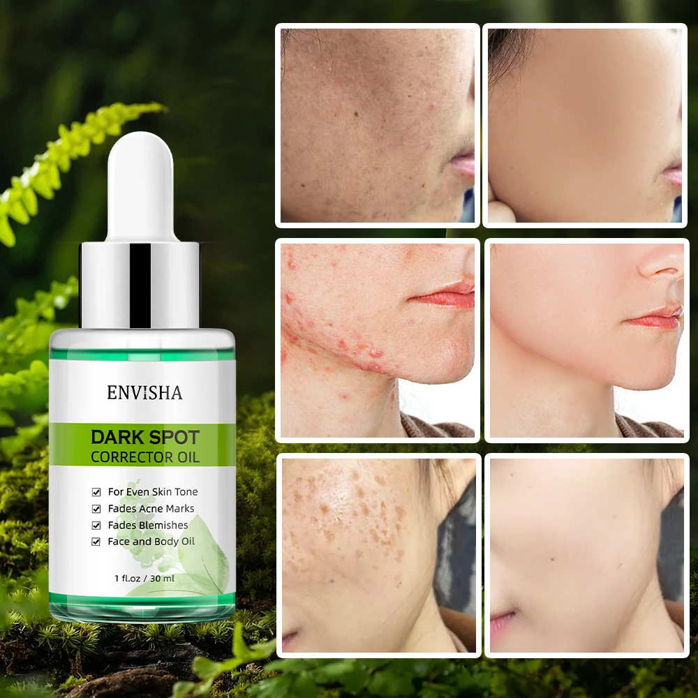 

ENVISHA Whitening Freckle Essential Oil Face Skin Care Serum Remove Melasma Dark Spots Melanin Brighten Anti-Aging Shrink Pores