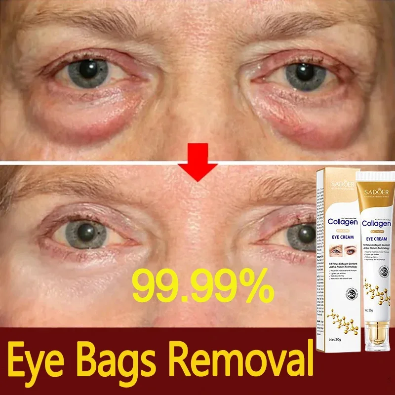 

Instant Eye Bag Removal Cream Collagen Removal Wrinkles Serum Fine Lines Firming Anti Dark Circle Puffiness Brighten Eye Care