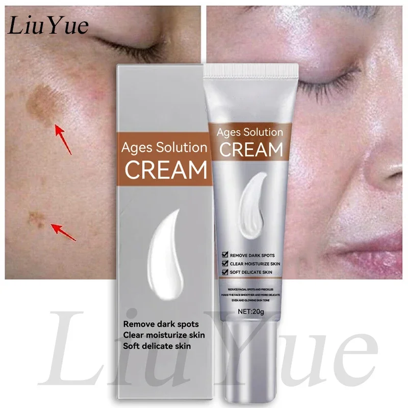 

Remove Dark Spots Anti-aging Cream Whiten Improve Fine Lines Anti-wrinkle Cream Niacinamide Brighten Serum Retinol Freckle Cream