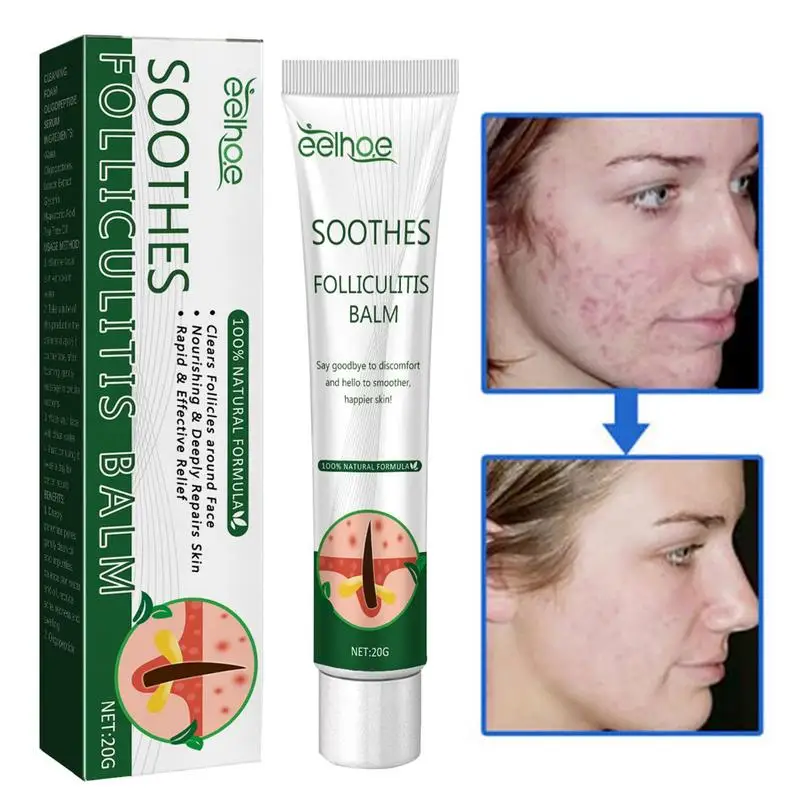 Восстановление лица крем, увлажняющий крем для лица, 30 г, Быстродействующее средство для лечения фолликулита кожи головы, успокаивает покраснения и кожу головы
Восстановление лица крем, увлажняющий крем для лица, 30 г, Быстродействующее средство для лечения фолликулита кожи головы, успокаивает покраснения и кожу головы