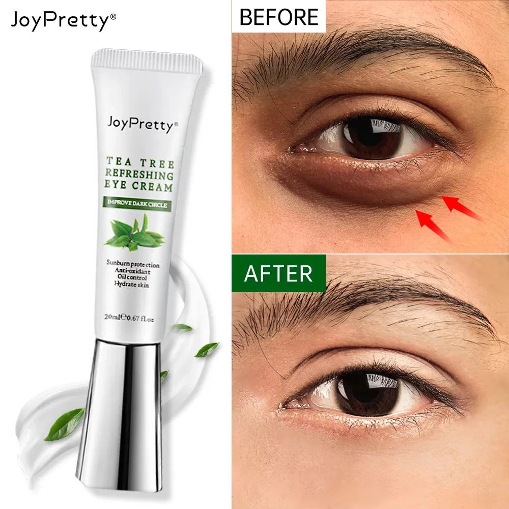 20g Anti Dark Circle Eye Cream Anti Wrinkle Fade Fine Lines Remove Eye Bags Puffiness Lifting Skin Care Beauty Health Eye Care
20g Anti Dark Circle Eye Cream Anti Wrinkle Fade Fine Lines Remove Eye Bags Puffiness Lifting Skin Care Beauty Health Eye Care