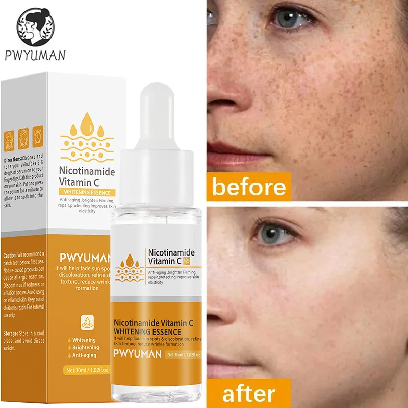 PWYUMAN Vitamin C Dark Spot Remover Serum Melanin Blemish Freckles Removal Nicotinamide Lightening Moisturizing Face Skin Care
PWYUMAN Vitamin C Dark Spot Remover Serum Melanin Blemish Freckles Removal Nicotinamide Lightening Moisturizing Face Skin Care