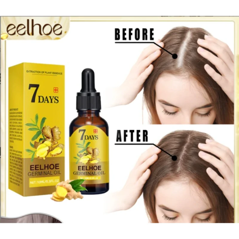 

Fast Hair Growth Ginger Growth Hair Oil Treatment Anti Hair Loss Men Women Scalp Treatment Serum Products Beauty Health