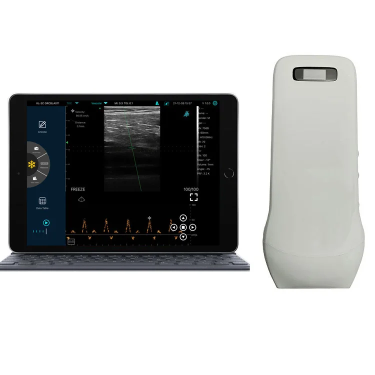 KONTED Wireless portable ultrasound machine color doppler ultrasound scanner for Abdomen Examination
KONTED Wireless portable ultrasound machine color doppler ultrasound scanner for Abdomen Examination