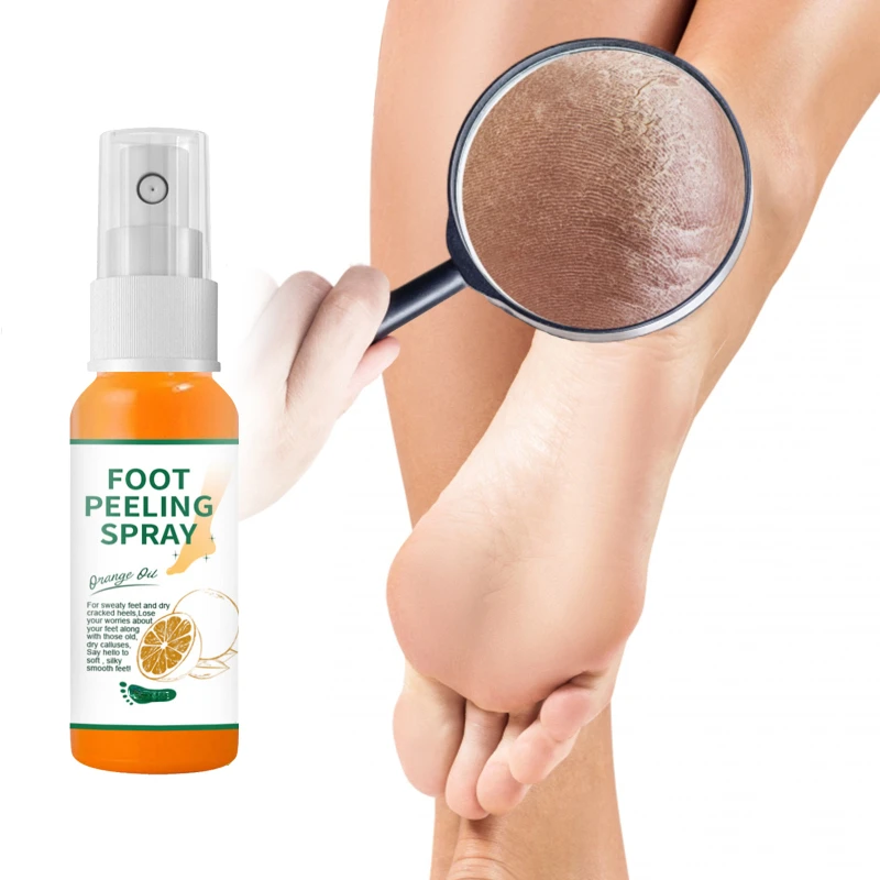 

Foot Care Spray Citrus Heel Elbow Knee Exfoliating Anti-Drying Crack Peeling Removal dead skin Calluses Hand Feet repair liquid