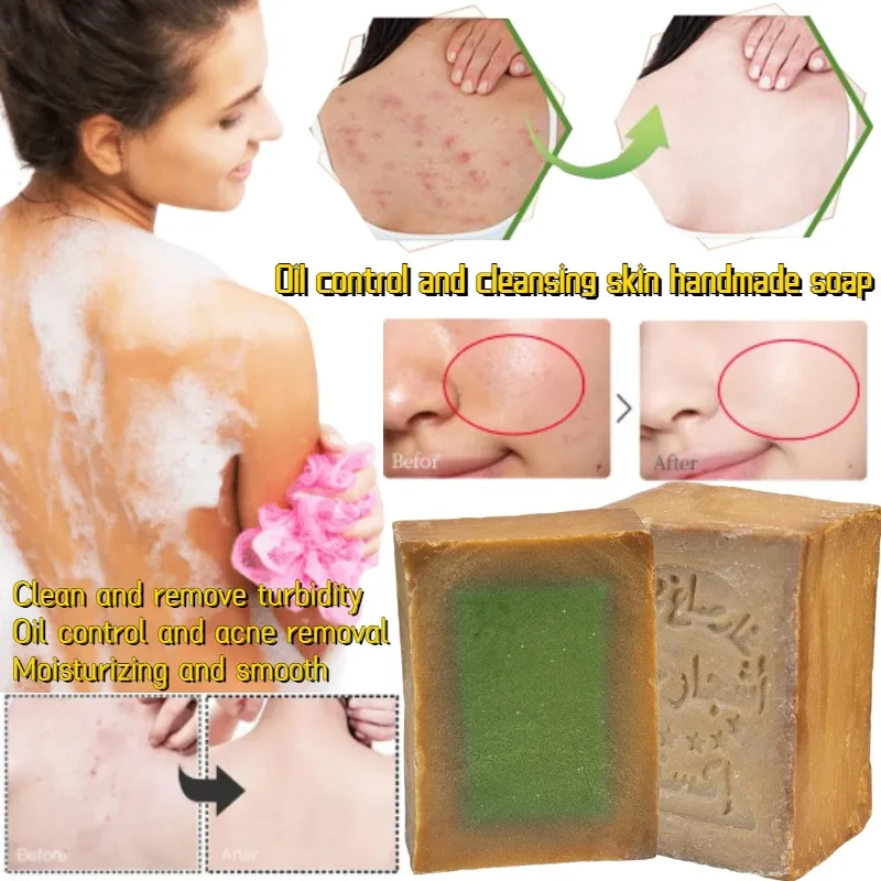 Contains Laurel Essence for Cleansing Bathing and Nourishing Skin Mild Cleaning Oil Control and Softening Cuticle Soap
Contains Laurel Essence for Cleansing Bathing and Nourishing Skin Mild Cleaning Oil Control and Softening Cuticle Soap