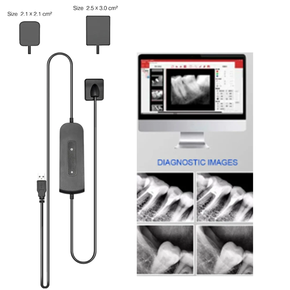 

Dentistry Sensor X-Ray Dental High-Frequency Rx Digital Intraoral Digital System H D Image Dentist Lab Implant Tools