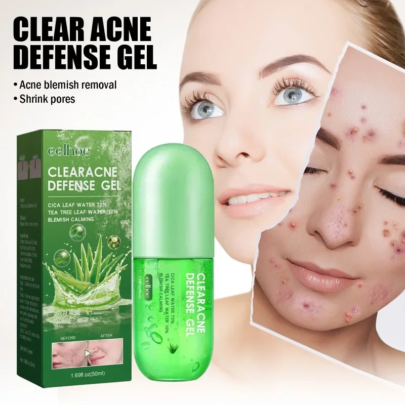 Natural Aloe Vera Acne repair gel fade face acne antibacterial treatment cream moisturizing whitening facial skin care Cosmetics
Natural Aloe Vera Acne repair gel fade face acne antibacterial treatment cream moisturizing whitening facial skin care Cosmetics