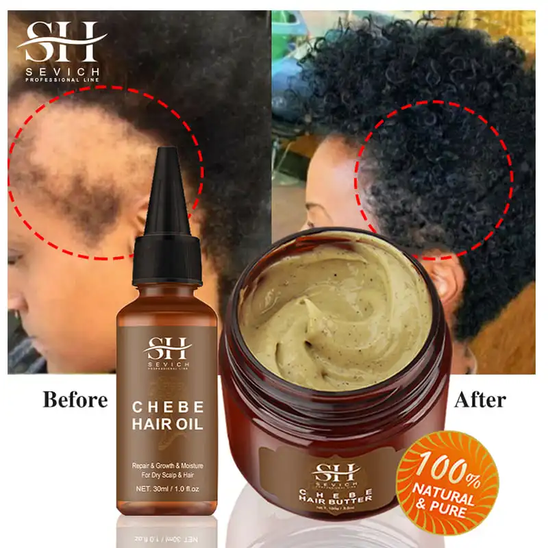 Chebe Traction Alopecia Thicken Oil Anti Hair Loss Treatment Spray Craze Fast Hair Growth Products Sevich Anti Break Hair Care
Chebe Traction Alopecia Thicken Oil Anti Hair Loss Treatment Spray Craze Fast Hair Growth Products Sevich Anti Break Hair Care