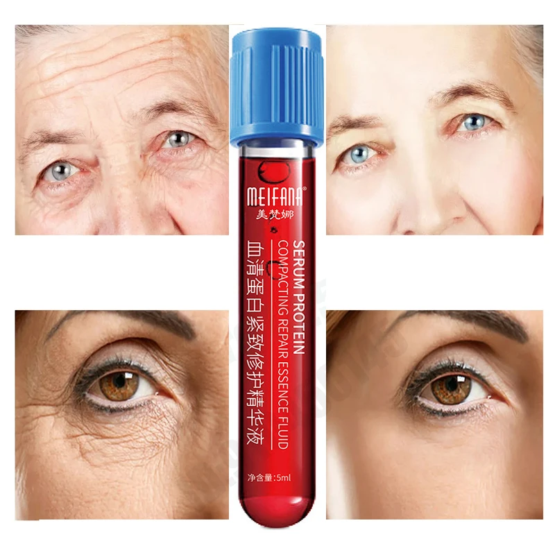 Face Skin Serum Anti Aging Erythrocyte Collagen Stem Cells Wrinkle Hydrating Essence Protein Firming Repairing Serum Korean
Face Skin Serum Anti Aging Erythrocyte Collagen Stem Cells Wrinkle Hydrating Essence Protein Firming Repairing Serum Korean