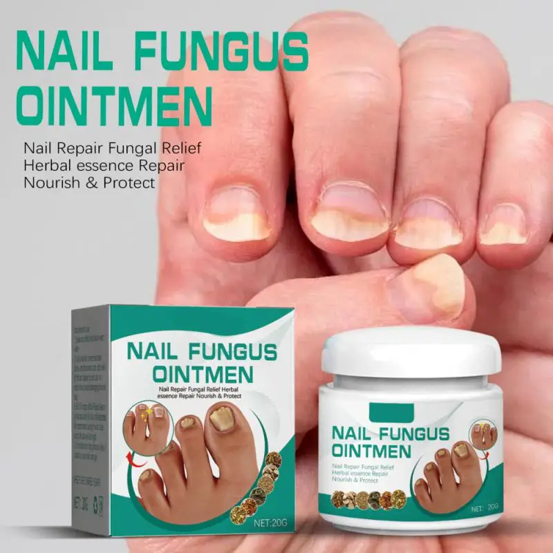 Onychomycosis Nail Fungus Extremely Strong Removal Foot Care Cream Anti- Paronychia Nail And Toe Powder
Onychomycosis Nail Fungus Extremely Strong Removal Foot Care Cream Anti- Paronychia Nail And Toe Powder