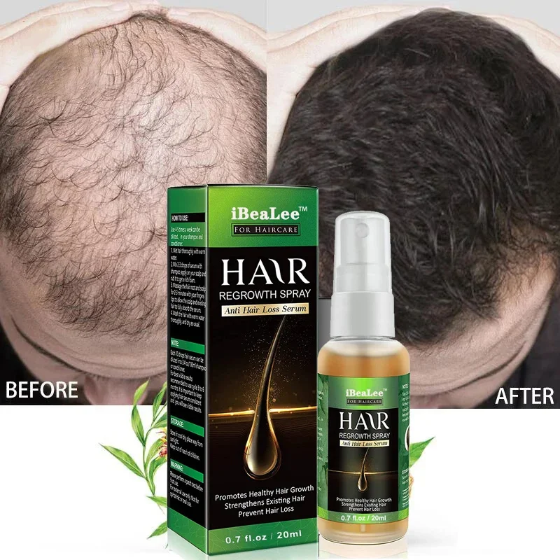 Ginger Hair Growth Products Fast Growing Essential Oil Biotin Prevent Loss Serum Spray Scalp Treatment Beauty Care For Men Women
Ginger Hair Growth Products Fast Growing Essential Oil Biotin Prevent Loss Serum Spray Scalp Treatment Beauty Care For Men Women