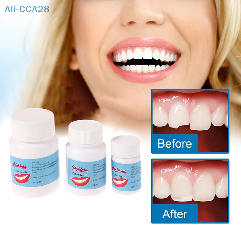 

5-30ml Dental Resin Shapeable Teeth Glue Makeup Dentures Modification Temporary Filling Teeth Repair Broken Teeth Tooth Gaps