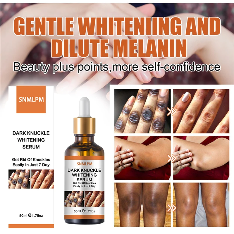 50ml Dark Knuckles Whitening Serum Elbow Armpit Knee Ankle Brightening Essence Lighten Melanin Dark Knuckle Remover
50ml Dark Knuckles Whitening Serum Elbow Armpit Knee Ankle Brightening Essence Lighten Melanin Dark Knuckle Remover