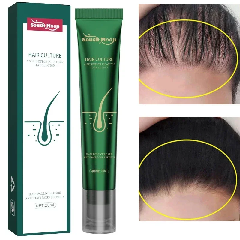 Fast Hair Growth Oil Hair Regrowth Thinning Treatment Serum Hair Growing Scalp Liquid Anti Loss Smooth Bright for Women Men
Fast Hair Growth Oil Hair Regrowth Thinning Treatment Serum Hair Growing Scalp Liquid Anti Loss Smooth Bright for Women Men