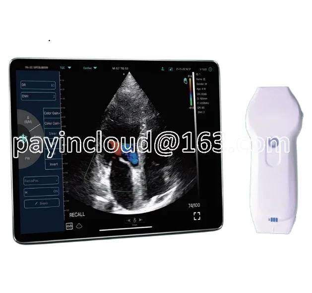 MC28 High technology ergonomic design wireless and USB cardiac phased array linear probe
MC28 High technology ergonomic design wireless and USB cardiac phased array linear probe