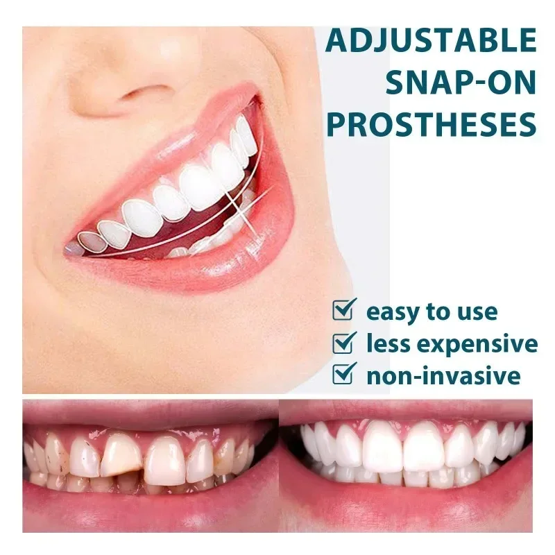 

Sdatter Adjustable Denture Teeth Set Instant Smiling Veneer Denture Whitening Tooth Natural Portable Braces Decorate Gaps Betwee