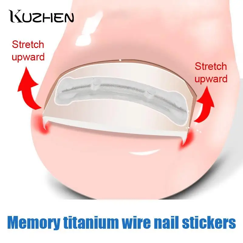 Ingrown Toenail Corrector Patches Paronychia Treatment Recover Care Pedicure Tools 25/30Pcs 13-19mm Nail Correction Stickers
Ingrown Toenail Corrector Patches Paronychia Treatment Recover Care Pedicure Tools 25/30Pcs 13-19mm Nail Correction Stickers