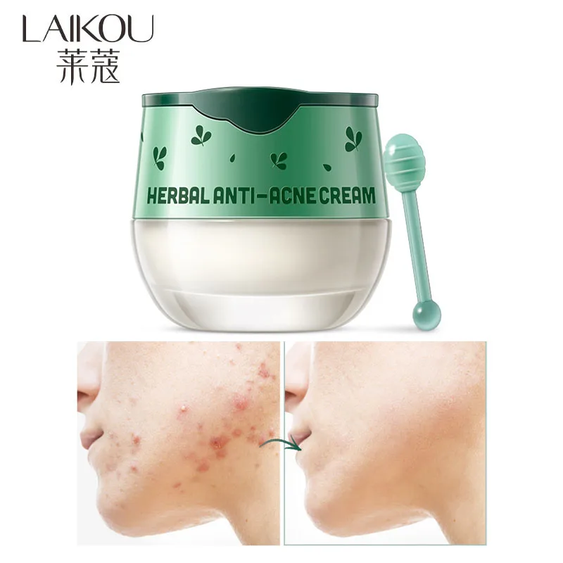 LAIKOU 8g Herbal Anti-Acne Cream Removal Herbal Oil Control Skin Care Shrink Whitening Moisturizing Fade Acne Scars Face Cream
LAIKOU 8g Herbal Anti-Acne Cream Removal Herbal Oil Control Skin Care Shrink Whitening Moisturizing Fade Acne Scars Face Cream