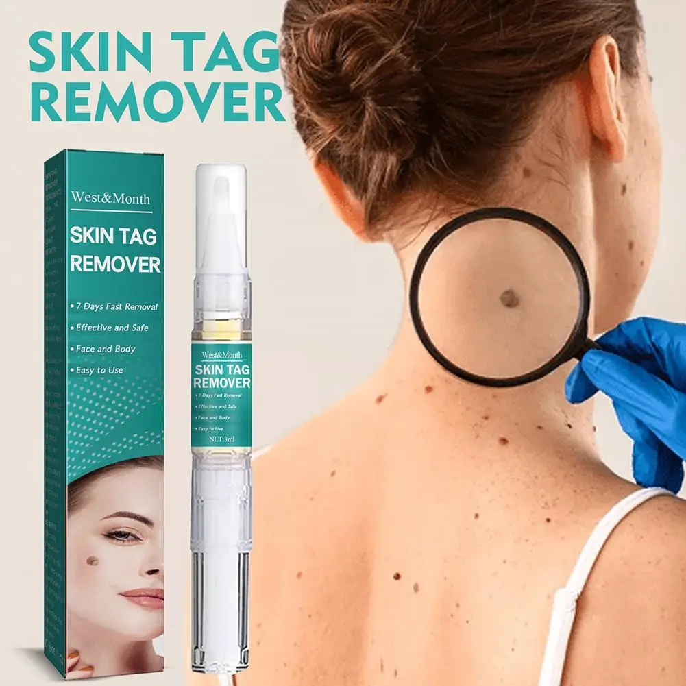 Wart Remover Pen Skin Tag Papillomas Moles Removal Liquid Point Mole Meat Neck Flat Black Mole Wart Painless Repair Pen
Wart Remover Pen Skin Tag Papillomas Moles Removal Liquid Point Mole Meat Neck Flat Black Mole Wart Painless Repair Pen