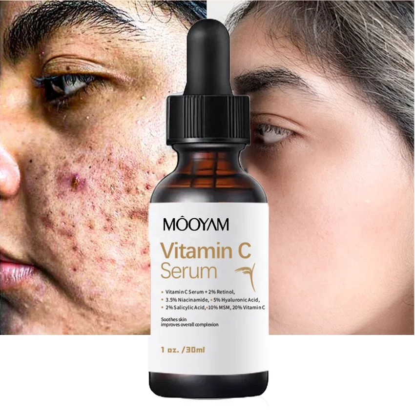 20% Vitamin C Serum with 2% Retinol 3.5% Niacinamide 5% Hyaluronic Acid 2% Salicylic Acid 10% MSM Brighten Skin Lighten Spots
20% Vitamin C Serum with 2% Retinol 3.5% Niacinamide 5% Hyaluronic Acid 2% Salicylic Acid 10% MSM Brighten Skin Lighten Spots