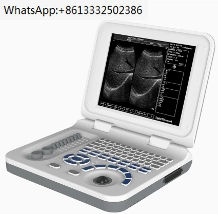 

Medical Full Digital Ultrasonido medico Price & B&W Portable Ultrasound Scanner Machine With convex array probe