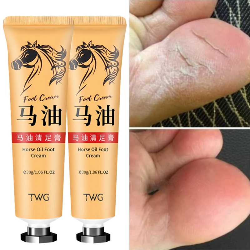 30g Anti Crack Foot Care Cream Dryness Foot Mask Heel Cracked Repair Cream Hand Moisture Removal Callus Dead Skin Hand Foot Care
30g Anti Crack Foot Care Cream Dryness Foot Mask Heel Cracked Repair Cream Hand Moisture Removal Callus Dead Skin Hand Foot Care