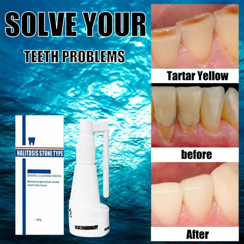 

All Natural Teeth Whitening Spray Clean Oral Hygiene Whiten Teeth Remove Calculus Halitosis Plaque Stains Fresh Breath