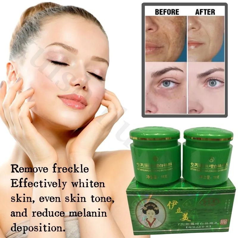 

Face Quick Freckles Removal Cream Whitening Fade Spots Emulsion Remove Melasma Brighten Cream for Dark Skin Women Whiten Product