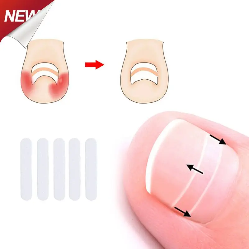 InFoot Care Ingrown Corrector with 5 Gifts Toe Nail Fixer Pedicure Toenail Recover Correction Tool Foot Care Kit TSLM1
InFoot Care Ingrown Corrector with 5 Gifts Toe Nail Fixer Pedicure Toenail Recover Correction Tool Foot Care Kit TSLM1