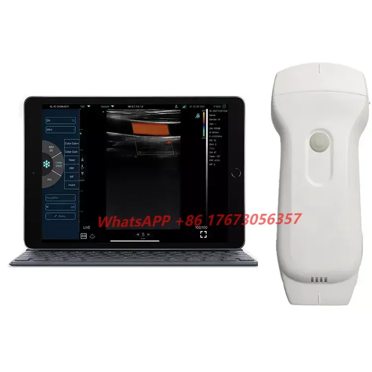 

USB WIFI Types Portable Color Doppler Wireless Ultrasound Machine/Probe Convex+Linear+Cardiac C10RL