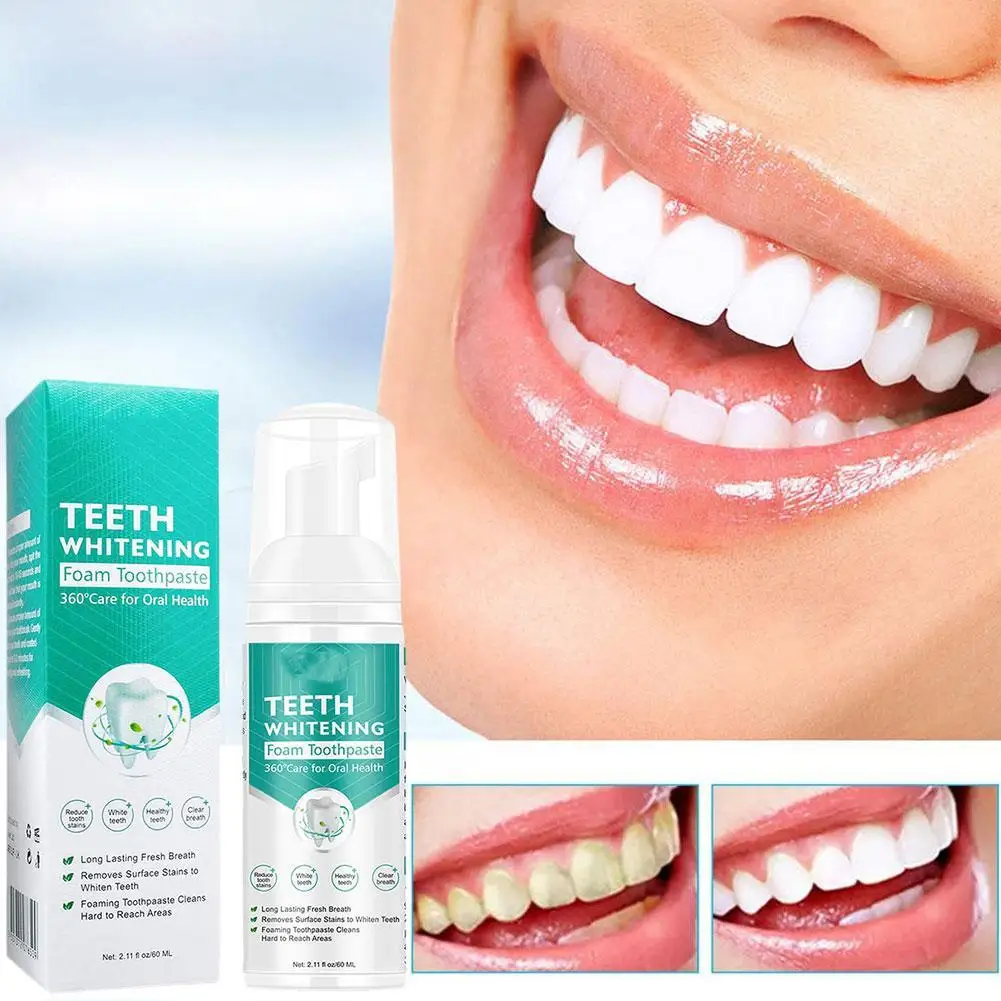 

Tooth Cleaning Mousse Teeth Yellow Smoke Stains Tartar Removal Mouth Anti-cavity Fresh Breath Oral Whitening Press Toothpaste