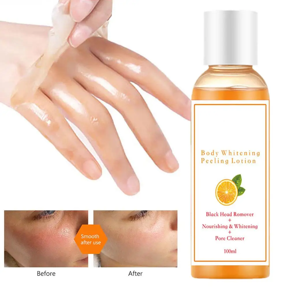 100ml Most Effective Orange Peeling Oil Knuckles Whitening for Remove Dead Skin Exfoliating New Skin Anti Dark Spots Oil A3W4
100ml Most Effective Orange Peeling Oil Knuckles Whitening for Remove Dead Skin Exfoliating New Skin Anti Dark Spots Oil A3W4