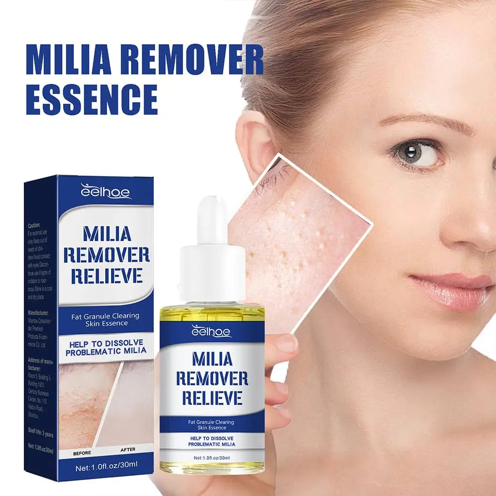 30ml Milia Remover Relieve Serum Dark Spot Remover Moisturizer Dark Brighten Reduce Circle Care Beauty Essences Helps F3R0
30ml Milia Remover Relieve Serum Dark Spot Remover Moisturizer Dark Brighten Reduce Circle Care Beauty Essences Helps F3R0