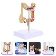 Human Large Intestine Pathology Model Human Colon Pathological Model for Teaching
Human Large Intestine Pathology Model Human Colon Pathological Model for Teaching