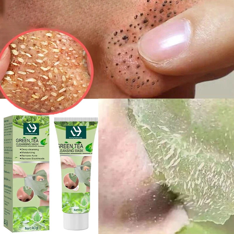 Face Blackhead remover Nose Oil Control Deep Pore Cleansing Dirt and Blackhead Removal For blackheads removal nose mask 
Face Blackhead remover Nose Oil Control Deep Pore Cleansing Dirt and Blackhead Removal For blackheads removal nose mask