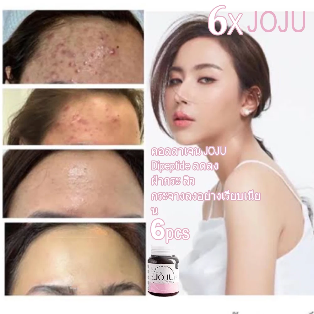 6X JOJU Collagen Dipeptide Reduce Acne Dark Spots Freckles oil control Smooth Lightening Whiten and brighten Younger Skin Care
6X JOJU Collagen Dipeptide Reduce Acne Dark Spots Freckles oil control Smooth Lightening Whiten and brighten Younger Skin Care