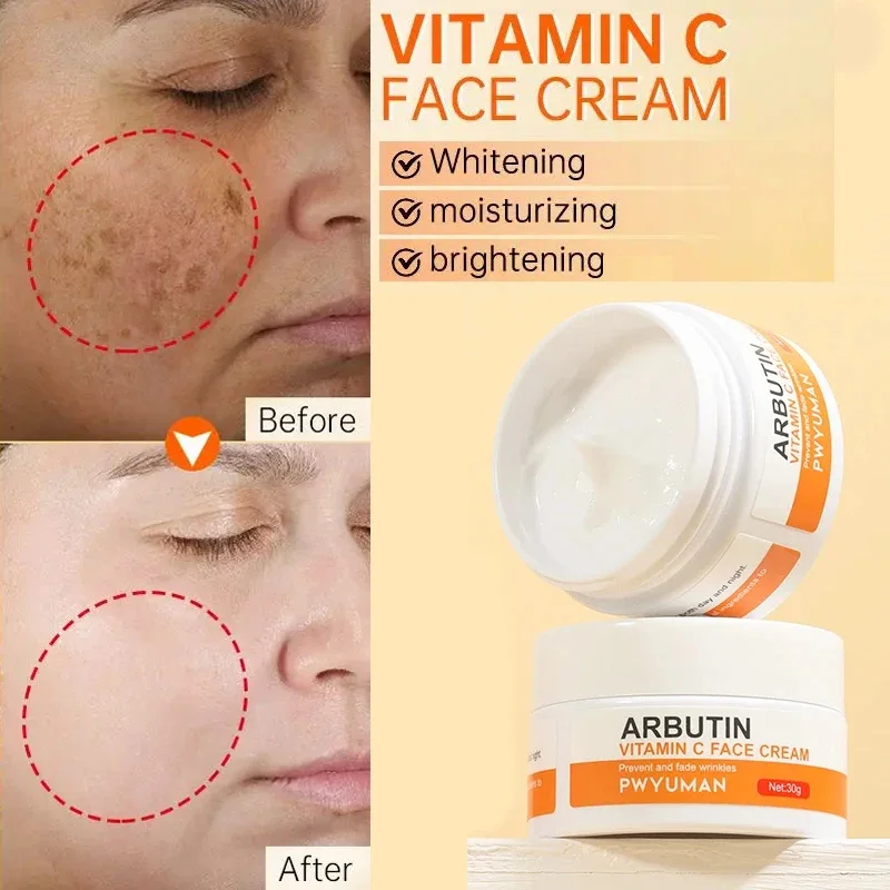 

Vitamin C Whitening Freckles Cream For Dark Skin Face Spots Removal Melasma Armpit Bleaching Moisturizing Brightening Skin Care