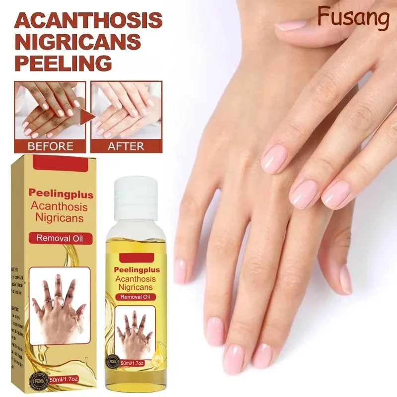 Knuckles Whitening Oil Legs Elbows Arm Knee Brighten Serum Finger Joints Whiten Peeling Oil Dark Skin Brightening Whiten Essence
Knuckles Whitening Oil Legs Elbows Arm Knee Brighten Serum Finger Joints Whiten Peeling Oil Dark Skin Brightening Whiten Essence