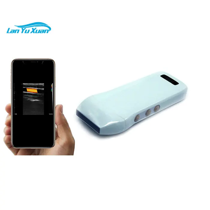 5G wifi Channel Konted 192 Elements Wireless Ultrasound iPad iPhone Ultrasound Probe / Scanner
5G wifi Channel Konted 192 Elements Wireless Ultrasound iPad iPhone Ultrasound Probe / Scanner
