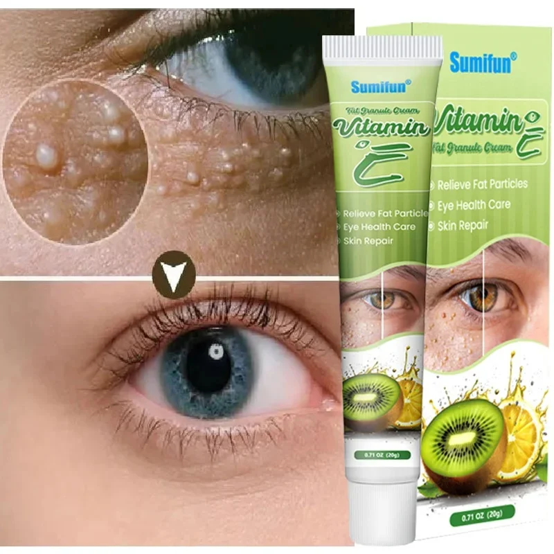

Fat Granules Remover Eyes Cream Improve Eye Bag Fade Fine Lines Moisturizing Anti-Puffiness Lifting Firming Eye Care Products