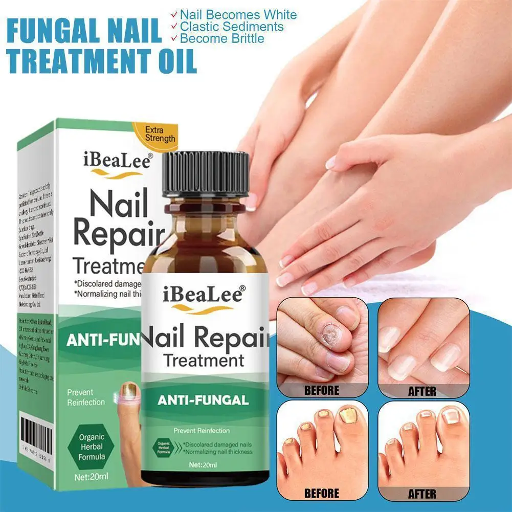 20ml Grey Nail Repair Solution Thickening Grey Nail Bottle Solution Repair Foot Brightening Solution Oil Empty Cuticle
20ml Grey Nail Repair Solution Thickening Grey Nail Bottle Solution Repair Foot Brightening Solution Oil Empty Cuticle