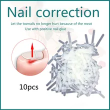 10 Pcs Ingrown Toenail Correction Tool Ingrown Toe Nail Treatment Elastic Patch Sticker Straightening Clip Brace Pedicure Tools
10 Pcs Ingrown Toenail Correction Tool Ingrown Toe Nail Treatment Elastic Patch Sticker Straightening Clip Brace Pedicure Tools