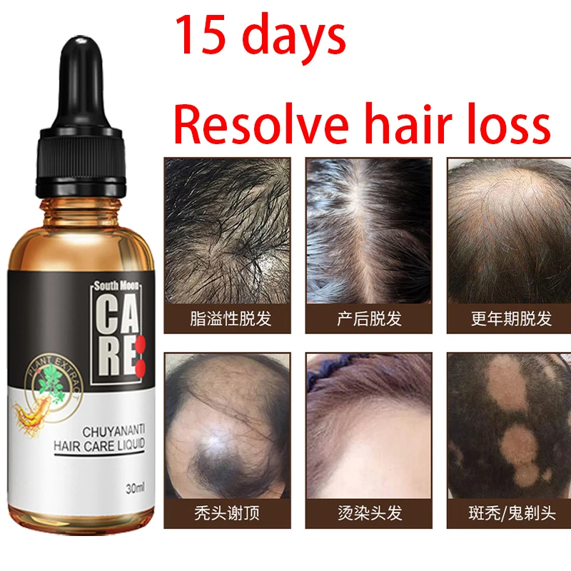 

Anti hair loss and hair growth liquid spray special certificate ginger about ginger hair growth liquid