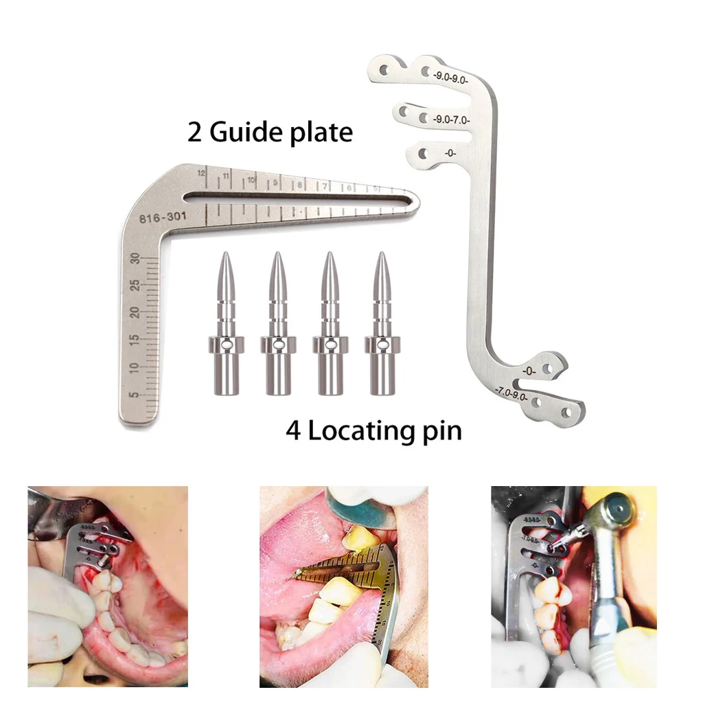 Dental Implant Guide Set Autoclavable Oral Planting Surgical Locator Angle Ruler Positioning Drilling Tool Dentistry Materials
Dental Implant Guide Set Autoclavable Oral Planting Surgical Locator Angle Ruler Positioning Drilling Tool Dentistry Materials
