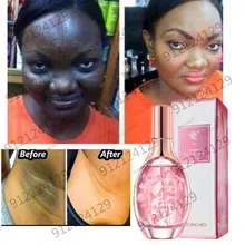 Whitening Facial Essence Rose Essence Hyaluronic Acid Oil Controlling Water Brightening Anti-aging Nourishing Skin Care Products
Whitening Facial Essence Rose Essence Hyaluronic Acid Oil Controlling Water Brightening Anti-aging Nourishing Skin Care Products